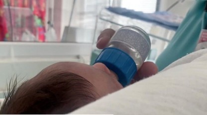 Seboroidná dermatitída nie je alergia: Mastné červené šupiny trápia najmä mužov