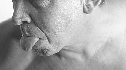 Lekár o nádoroch hlavy a krku: Naši pacienti chodia neskoro, TIETO príznaky si  všímajte!