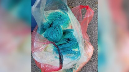 Na Slovensku zabíjala vážna infekcia! Listerióza ohrozuje najmä tehotné, chorých a deti