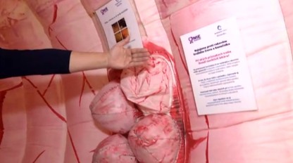 Máte vodnaté hnačky, no "nič vám nezistili"? Možno máte zriedkavé črevné ochorenie