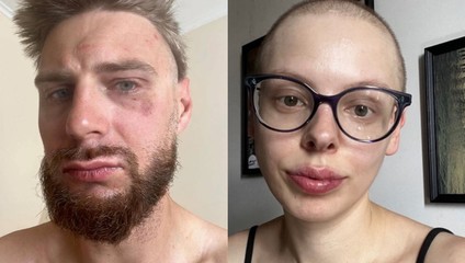 Poliak chcel vyzbierať peniaze pre partnerku s rakovinou. V Ostrave ho zbili pre modrožltú čiapku