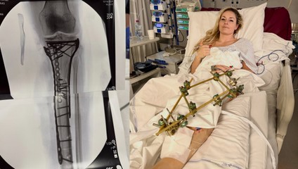 Hrozila mi amputácia, potvrdila Lindsey VONN