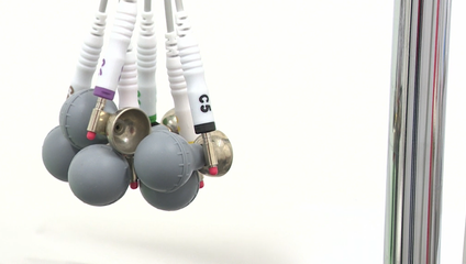 Má schválený liek, no dopláca 1700 eur mesačne. Raritní pacienti čakajú na spravodlivejší zákon