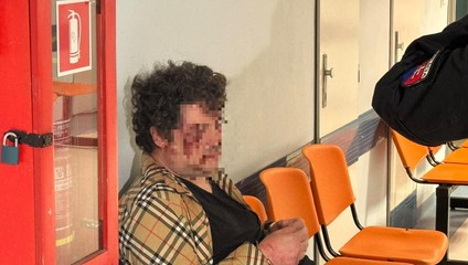 Ír zlomil zdravotníkovi v Bratislave nos. "Okradli ma," bránil sa v rozhovore