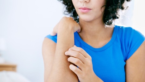 Kontaktná alergia:  Neuveríte, kde všade na tele môžete mať reakciu