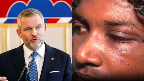 Prezident odsúdil násilie z nenávisti po útoku na cudzincov v Nitre