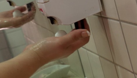 Choroba špinavých rúk sa stále šíri: Ako sa nenakaziť žltačkou?