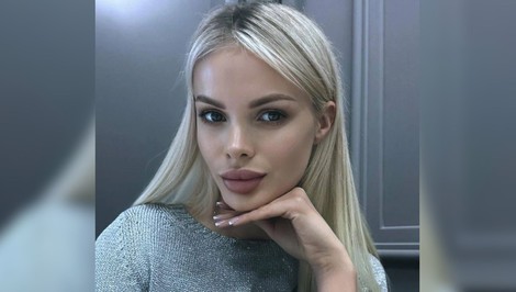 Modelka prišla o polovicu lebky. Útočník skolaboval po správe o treste
