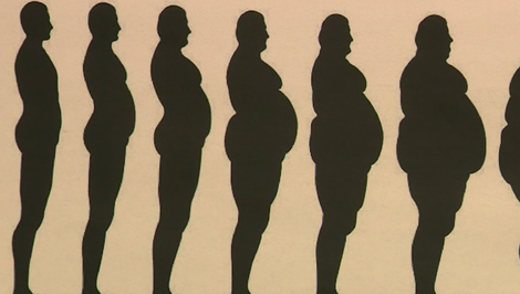 Liečba obezity sa mení: Nové lieky pomáhajú znižovať hmotnosť až o 20 percent