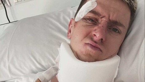 Dolámaný POGAČAR zverejnil fotku z nemocnice