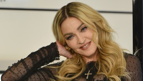 67-ročná Madonna TO opäť urobila a fanúšikovia ju prosia: „Prosím, oblečte sa!“