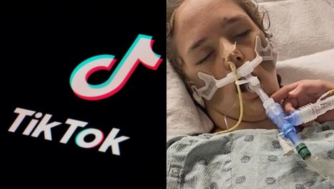 Tínedžerka utrpela po virálnej výzve mozgovú smrť. Chcela byť slávna na TikToku