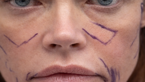 Brutálna premena známej herečky po liftingu: Fotky PRED a PO vás šokujú!