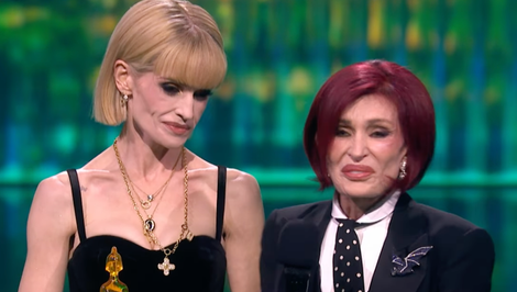 Vydesila fanúšikov! Tvár niekdajšej bacuľky je vychudnutá priam na lebku!