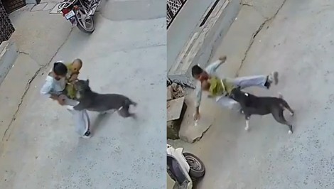 VIDEO: Desivý útok pitbulla na bábätko. Pes sa zahryzol do dieťaťa a nechcel ho pustiť
