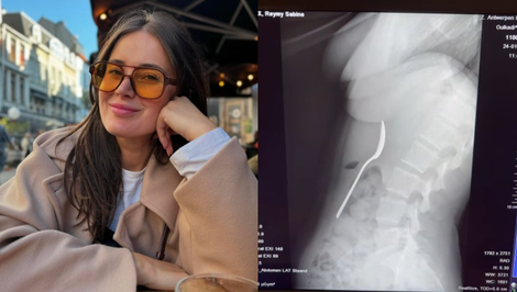 Pozor, na obyčajnú činnosť. Žena pri nej prehltla celú lyžicu