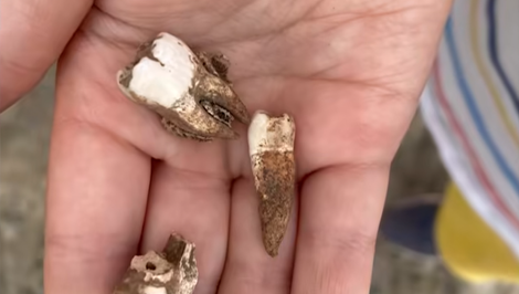 Chlapec (7) našiel na pláži zuby: Archeológovia potom odhalili masový hrob