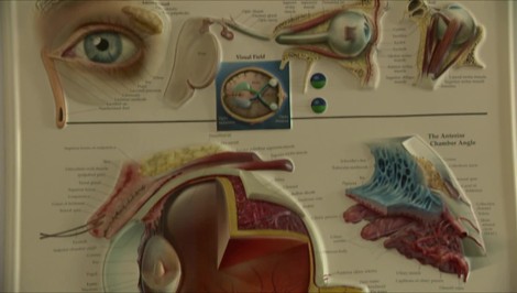Vidíte rozmazane do blízka aj do diaľky? Možno máte toto ochorenie rohovky