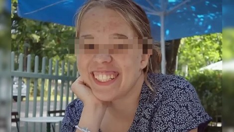 Študentka (†21) prišla do nemocnice s obyčajnou zlomeninou. Po 14 hodinách bola mŕtva