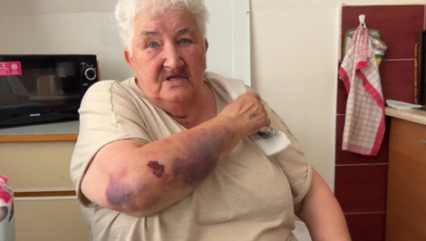 Dôchodkyňa bránila svojho invalidného syna pred útočníkmi. Obaja skončili so zraneniami