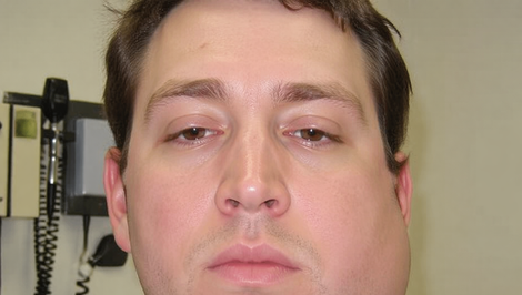 Postrach chlapcov a mladých mužov: Čo je to mumps a ako sa pred ním chrániť?