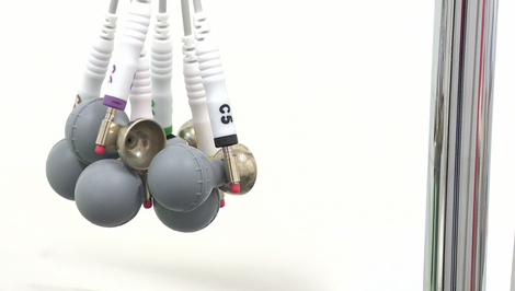 Má schválený liek, no dopláca 1700 eur mesačne. Raritní pacienti čakajú na spravodlivejší zákon