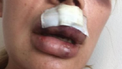 Nielen sexistické názory, ale aj násilnosti?! Známy český boháč údajne zbil expriateľku!