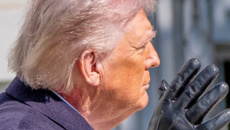 Červený fľak na krku Donalda Trumpa vyvolal otázky: Biely dom odhaľuje príčinu