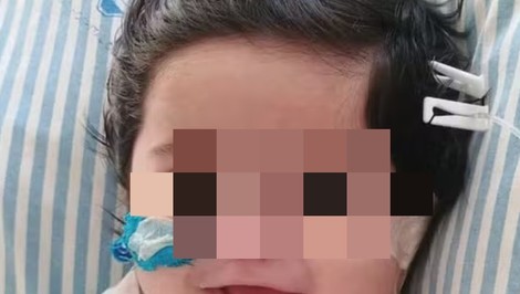 Štvormesačný chlapček zomrel v nemocnici. Sestrička mu do žily vstrekla mlieko