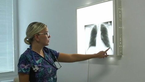Nedostatok pľúcnych lekárov: Nové ambulancie sa finančne neoplatia, čo bude s pacientmi?