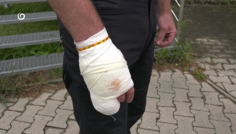 Medveď zaútočil na muža v Závažnej Porube: Spôsobil mu ľahké zranenia