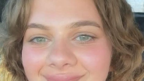 Študetku (†19) našli mŕtvu na internáte. Užívala populárny liek na chudnutie