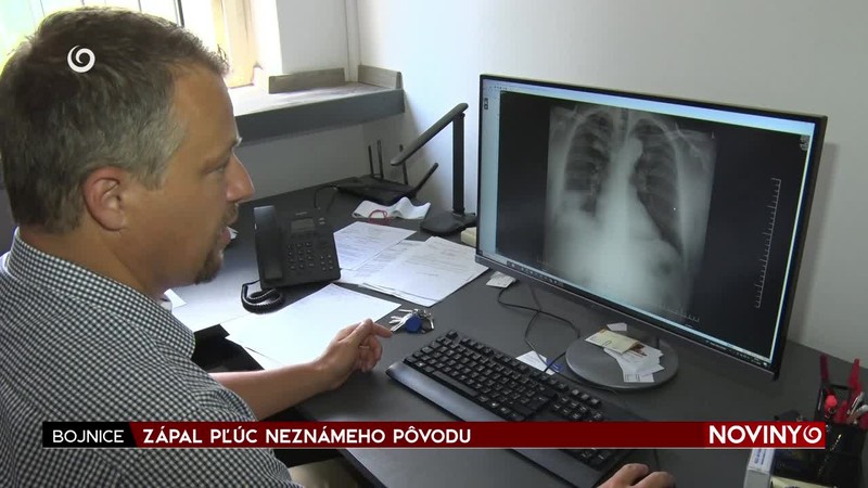 ZÁPAL PĽÚC NEZNÁMEHO PÔVODU