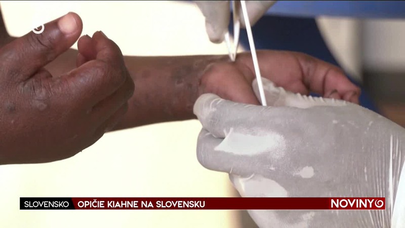 OPIČIE KIAHNE NA SLOVENSKU