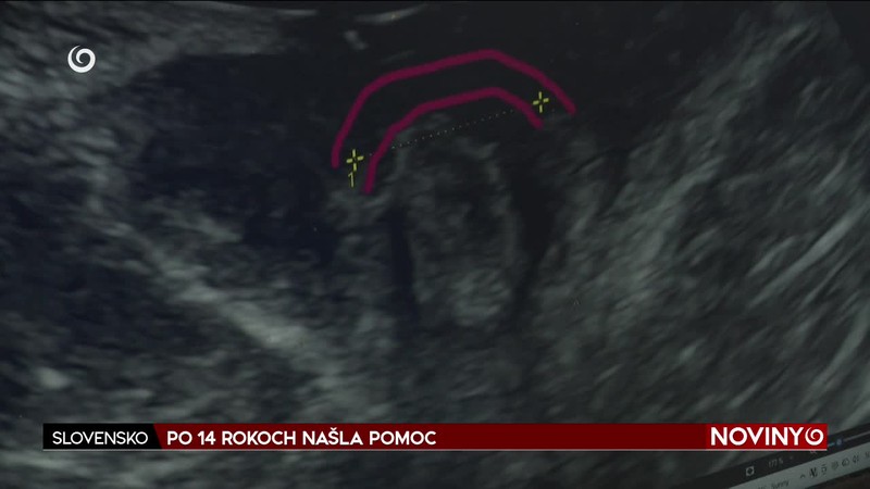 PO 14 ROKOCH NAŠLA POMOC