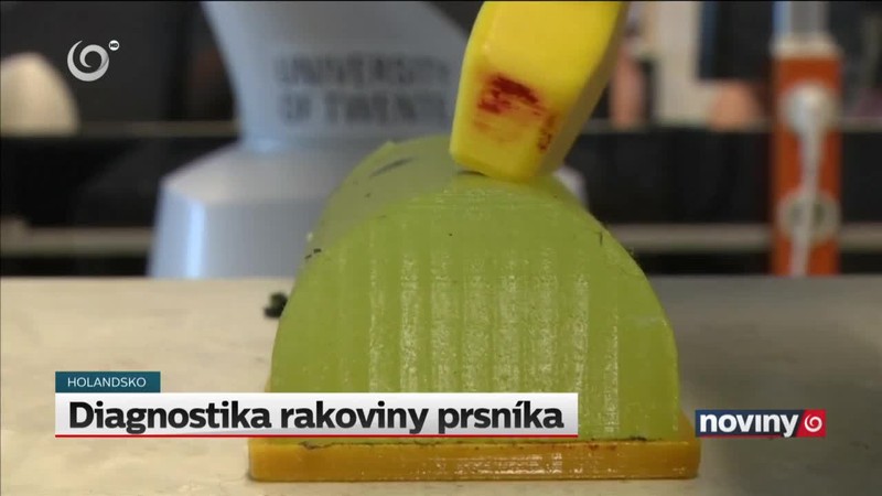 Diagnostika rakoviny prsníka