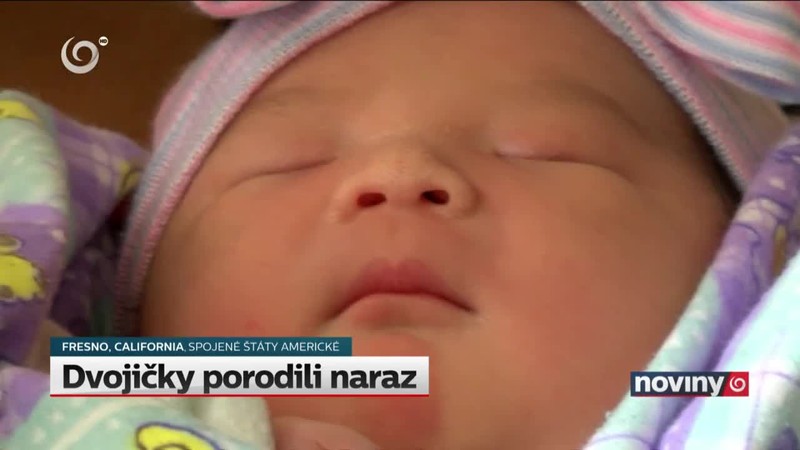 Dvojičky porodili naraz