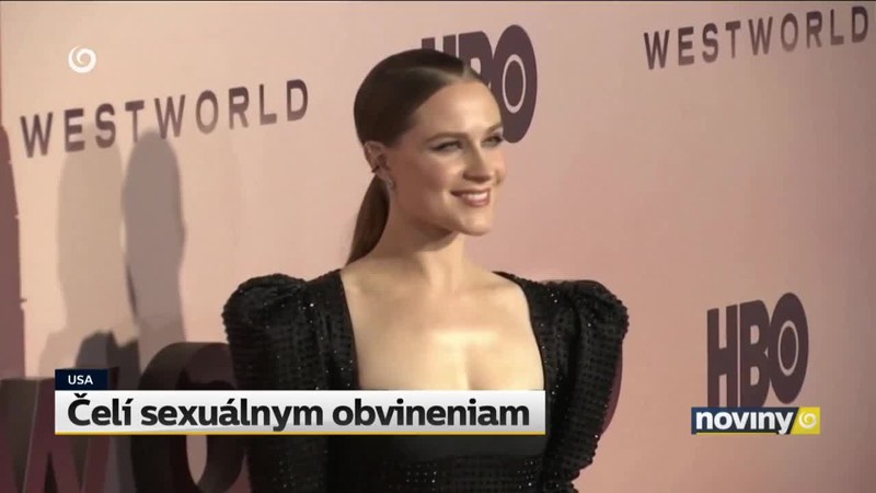 Čelí sexuálnym obvineniam