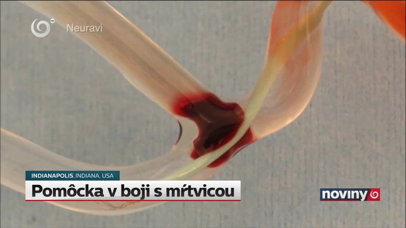 Pomôcka v boji s mŕtvicou