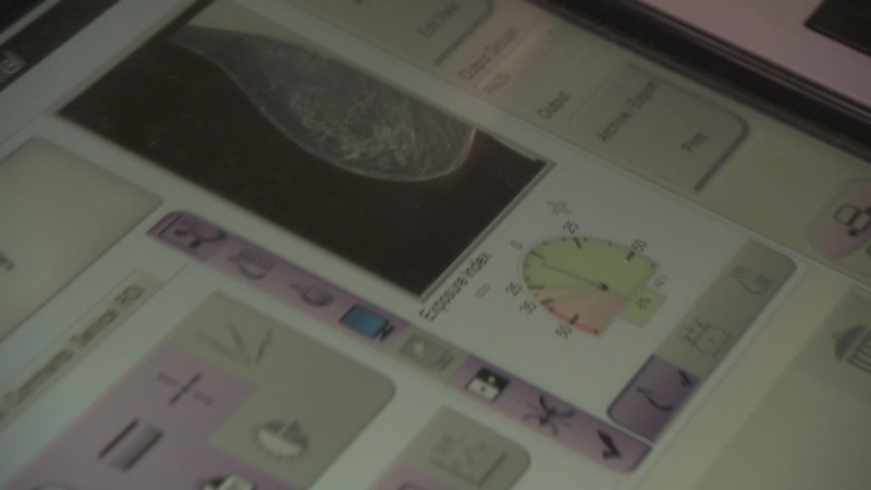 Prevencia rakoviny prsníka