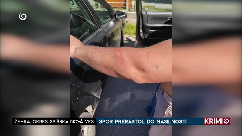 SPOR PRERÁSTOL DO NÁSILNOSTI