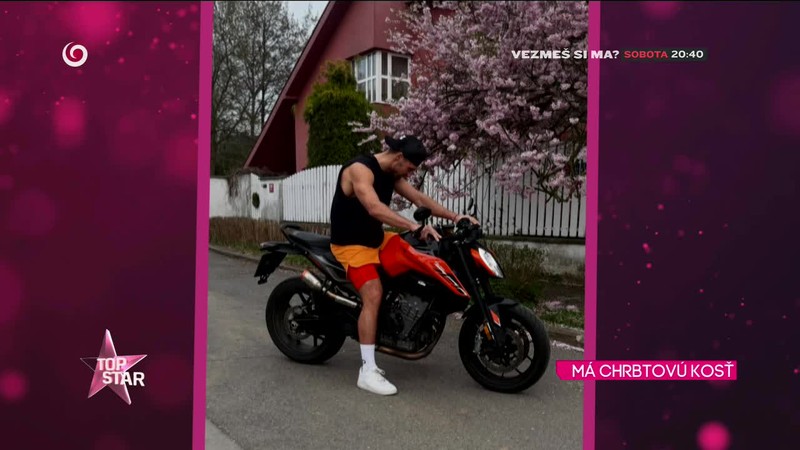 MÁ CHRBTOVÚ KOSŤ