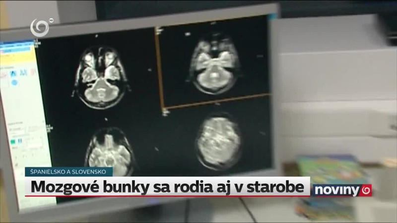 Mozgové bunky sa rodia aj v starobe