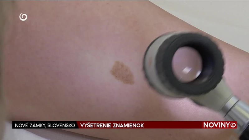 VYŠETRENIE ZNAMIENOK