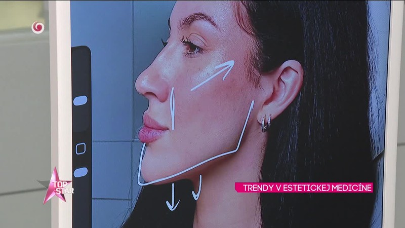 TRENDY V ESTETICKEJ MEDICÍNE