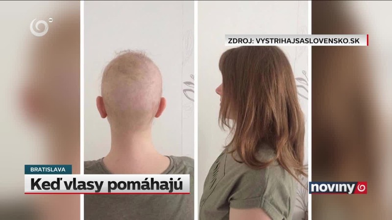 Keď vlasy pomáhajú