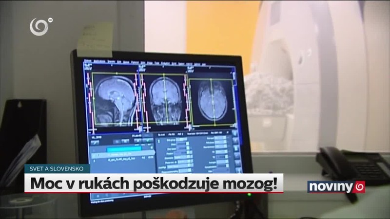 Moc v rukách poškodzuje mozog