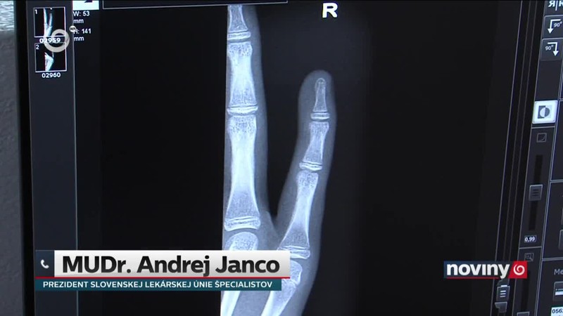 Obmedzenia v nemocniciach