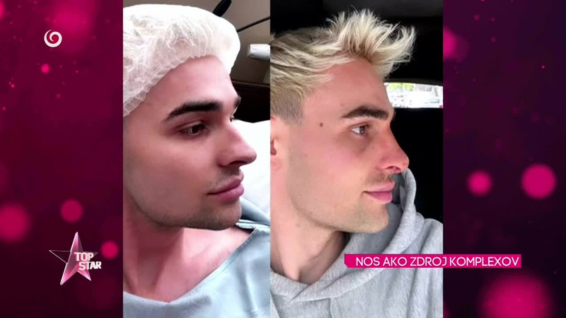 NOS AKO ZDROJ KOMPLEXOV