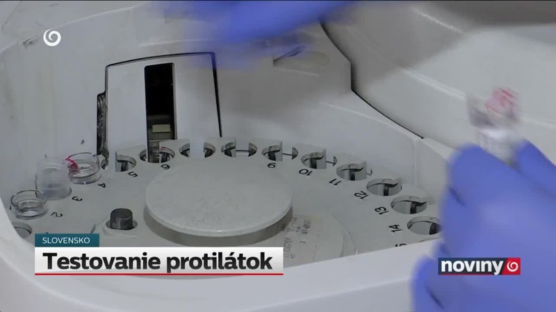 Testovanie protilátok